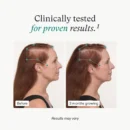 Nutrafol Women’s Hair Growth Supplements