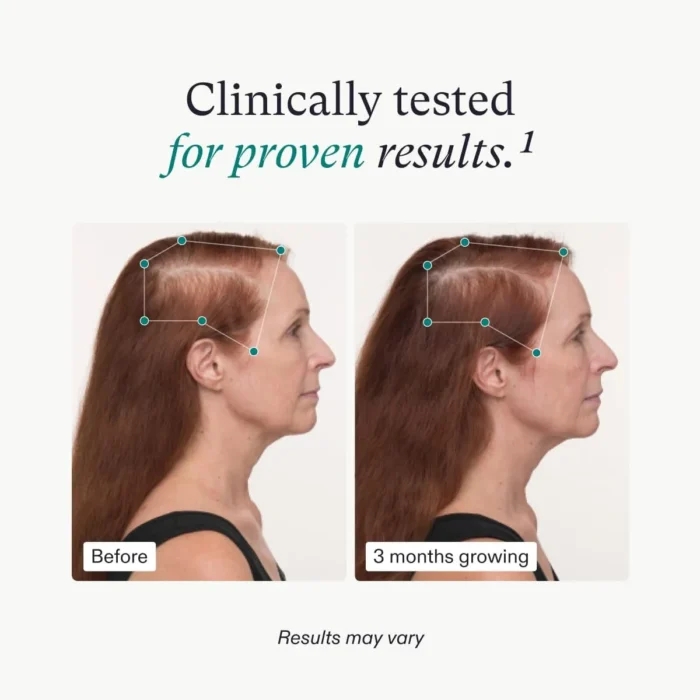 Nutrafol Women’s Hair Growth Supplements - Image 2