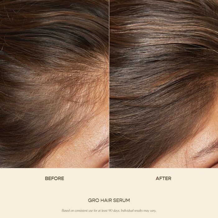 VEGAMOUR GRO Hair Serum Wholesale - LOW MOQ - Image 2