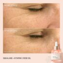 BIOSSANCE Squalane + Vitamin C Rose Oil. Facial Oil to Visibly Brighten, Hydrate, Firm and Reveal Radiant Skin