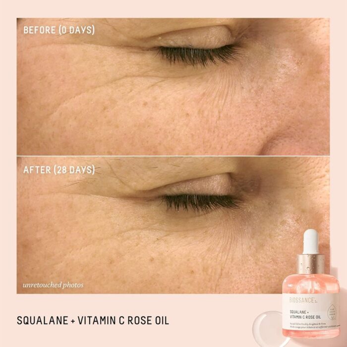 BIOSSANCE Squalane + Vitamin C Rose Oil. Facial Oil to Visibly Brighten, Hydrate, Firm and Reveal Radiant Skin - Image 2
