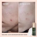 BIOSSANCE Squalane + Copper Peptide Rapid Plumping Serum