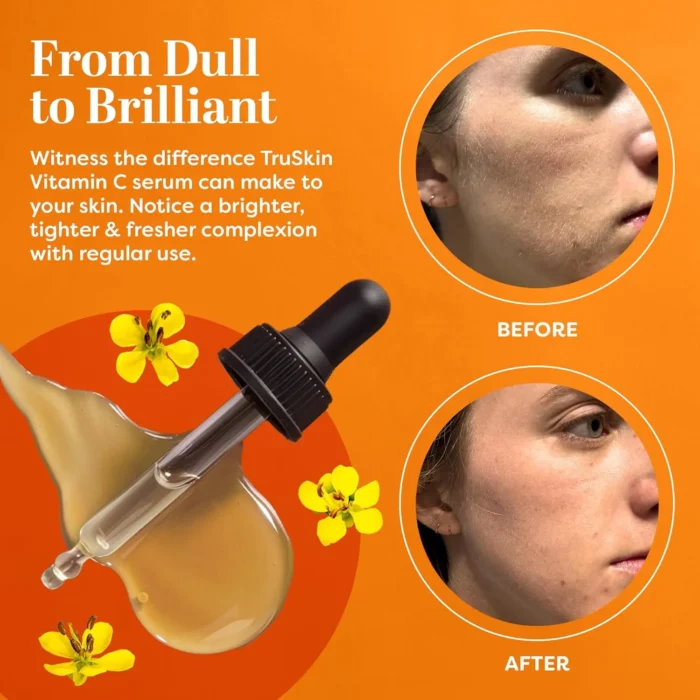 TruSkin Vitamin C Serum at Wholesale – Low MOQ - Image 3