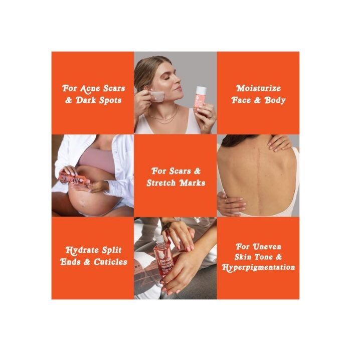 Bio-Oil Skincare Body Oil Serum, Face and Body Moisturizer with Vitamin E & A, for Scars, Stretch Marks, Sensitive Skin, All Skin Types, Dermatologist Recommended, Non-Comedogenic, 6.7 Oz - Image 2