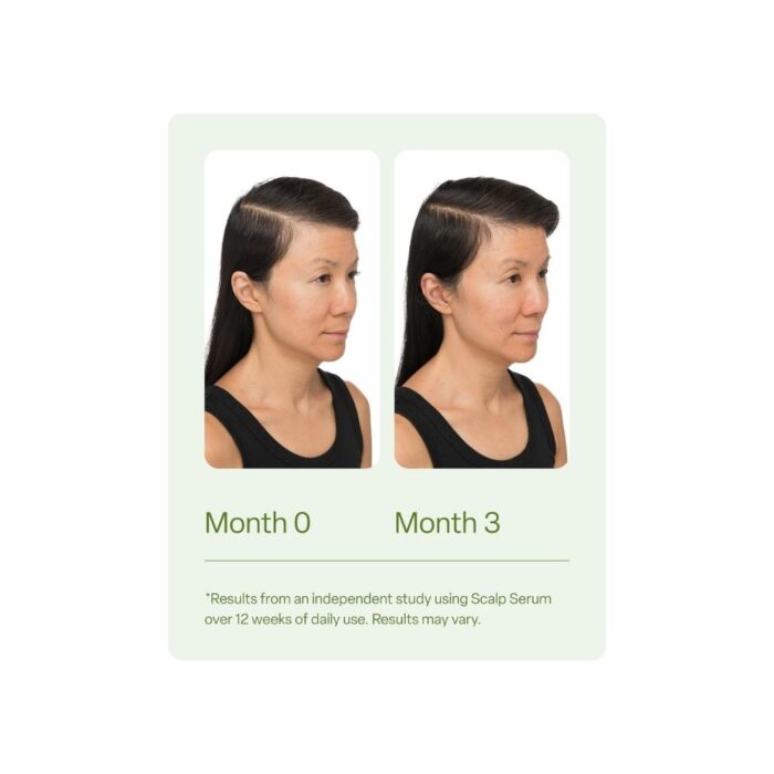 divi Scalp Serum for Thinning Hair, 30ml – Clinically Tested, Nourishing Formula with Amino Acids, Caffeine & Rosemary Oil – Promotes Healthy Scalp & Fuller-Looking Hair, Reduces Oil & Product Buildup - Image 2