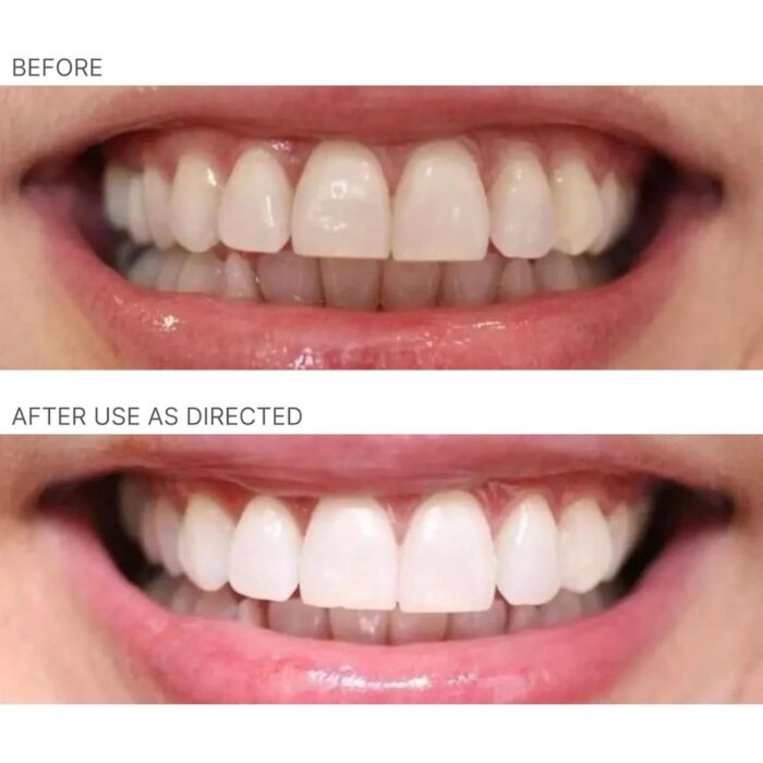 Nu Skin AP 24 Whitening Fluoride Toothpaste | 4oz | Brightens and Whitens Teeth | Helps Prevent Dental Cavities | Gentle Vanilla Mint Formula | 2 Pack - Image 3